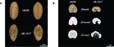 Identification of candidate gene for the defective kernel phenotype using bulked segregant RNA and exome capture sequencing methods in wheat